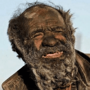 The World’s ‘Dirtiest’ Man Did Not Shower For Over 60 Years – His Reason Is Shocking