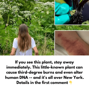 This little-known plant can cause third-degree burns and even alter human DNA — and it’s all over New York