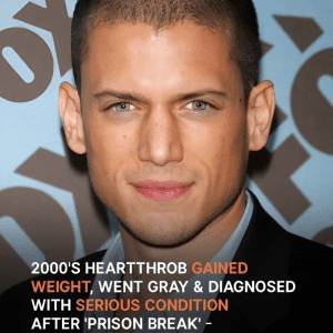 2000’s Heartthrob Gained Weight, Went Gray & Was Diagnosed with Serious Condition after ‘Prison Break’ – Before & after Pics